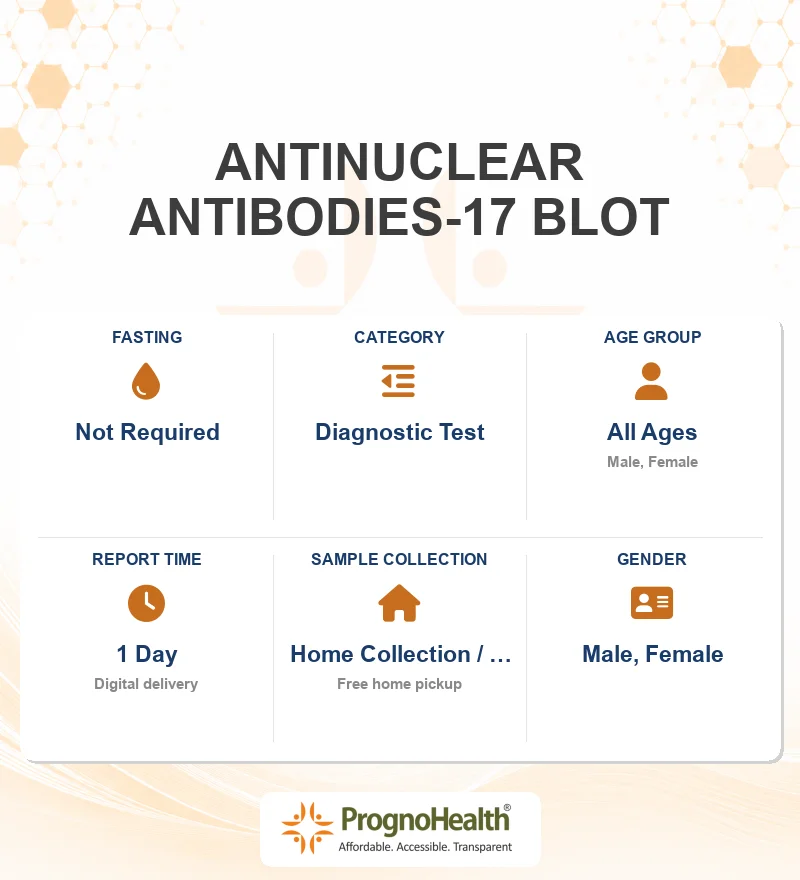 ANTINUCLEAR ANTIBODIES-17 BLOT