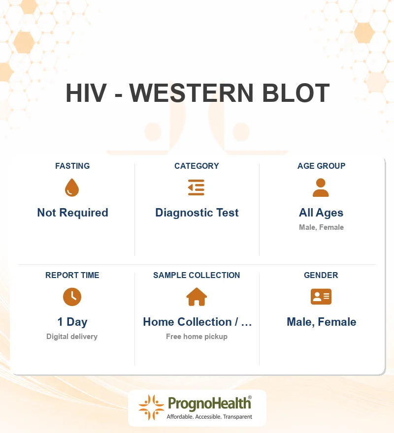 HIV - WESTERN BLOT