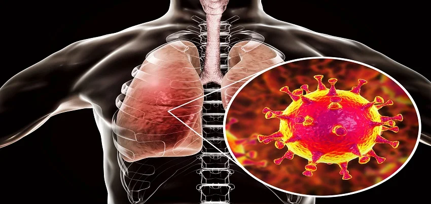 Middle East respiratory syndrome coronavirus (MERS-CoV)