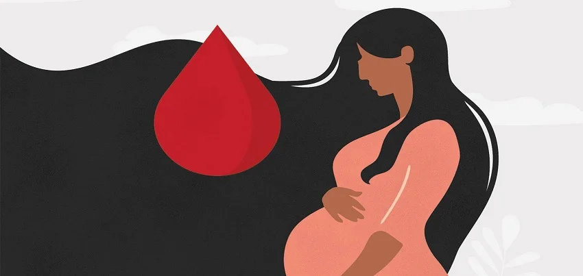 Antepartum hemorrhage, also known as bleeding in late pregnancy